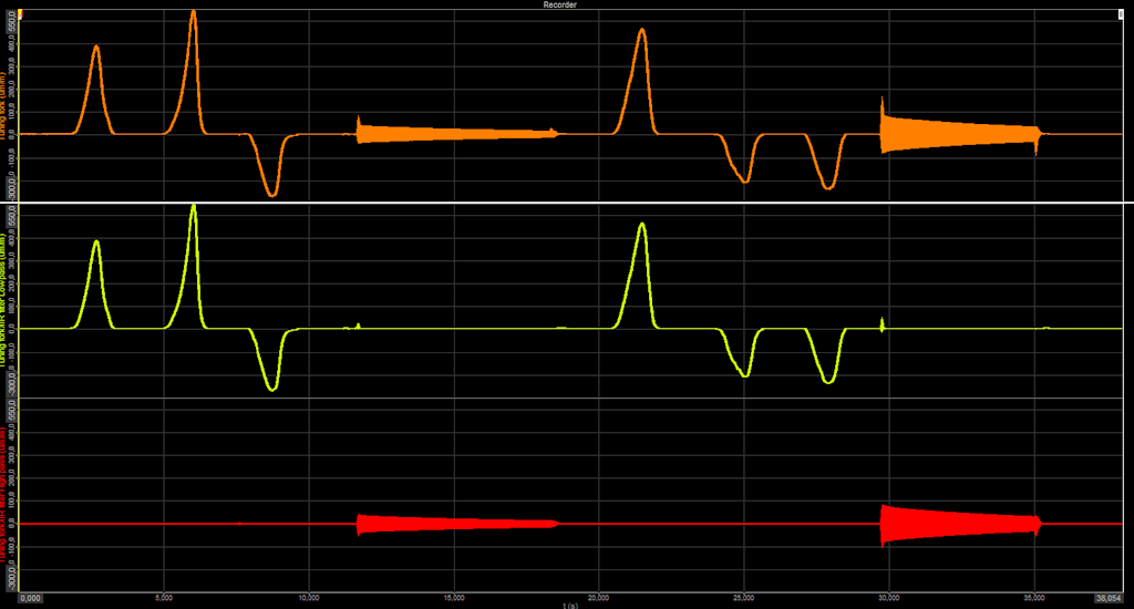 Raw signal, low-pass filter, and high-pass filter