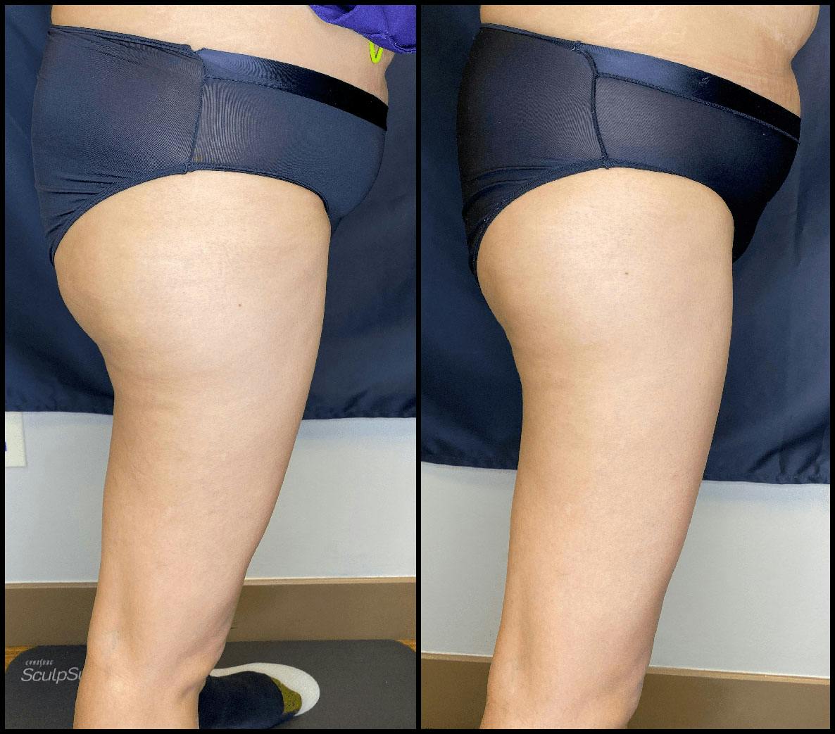 Evolve Before & After Gallery - Patient 92122905 - Image 7