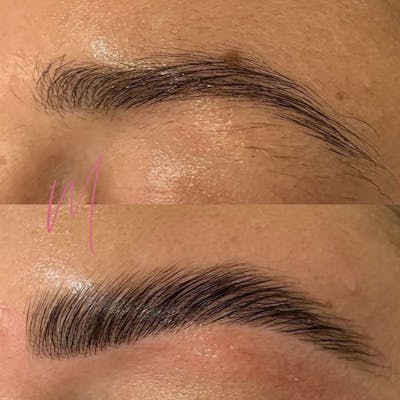 Eyebrow Microblading Before & After Gallery - Patient 781261 - Image 1