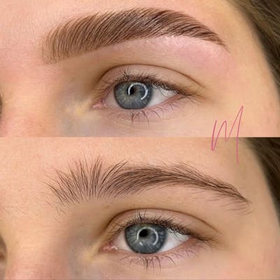 Eyebrow Microblading Before & After Gallery - Patient 844155 - Image 1