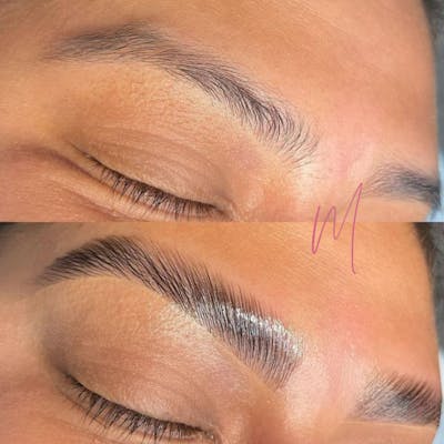 Eyebrow Microblading Before & After Gallery - Patient 146531 - Image 1