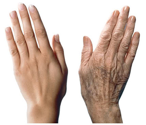 Dream Spa Medical Blog | What are Your Hands Exposing?Your AGE
