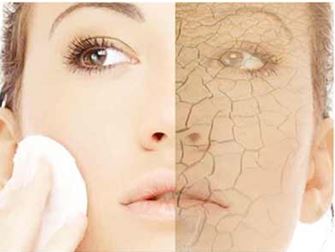 Dream Spa Medical Blog | Are you dry or dehydrated? - Boston