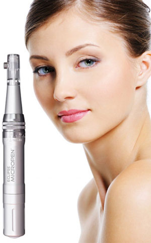 Dream Spa Medical Blog | Dream Spa Medical Gets Ground Breaking Results with PRP Microneedling!