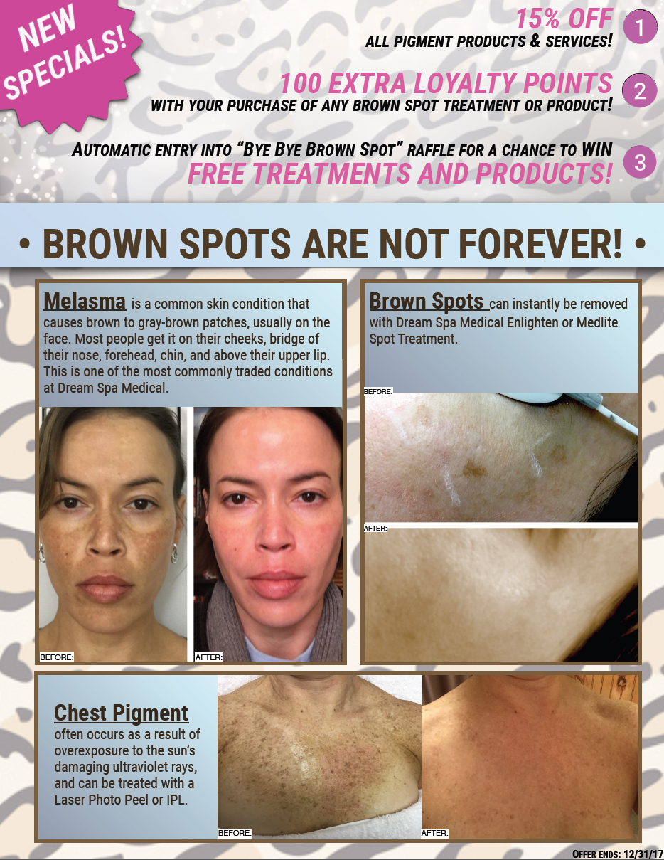 Dream Spa Medical Blog | Brown Spots Are Not Forever Special, Brookline MA