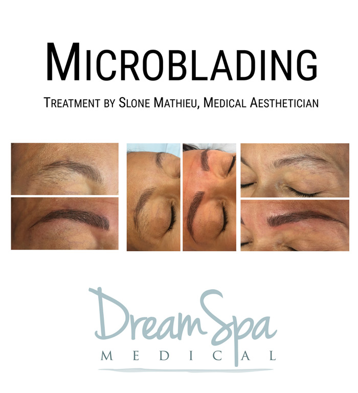 Dream Spa Medical Blog | Microblading Treatment