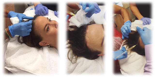 Dream Spa Medical Blog | Non-Surgical Hair Restoration: PRP Hair Injections