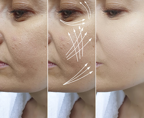 Dream Spa Medical Blog | Skin Tightening Treatment Gets Rid of Aging and Sagging Skin