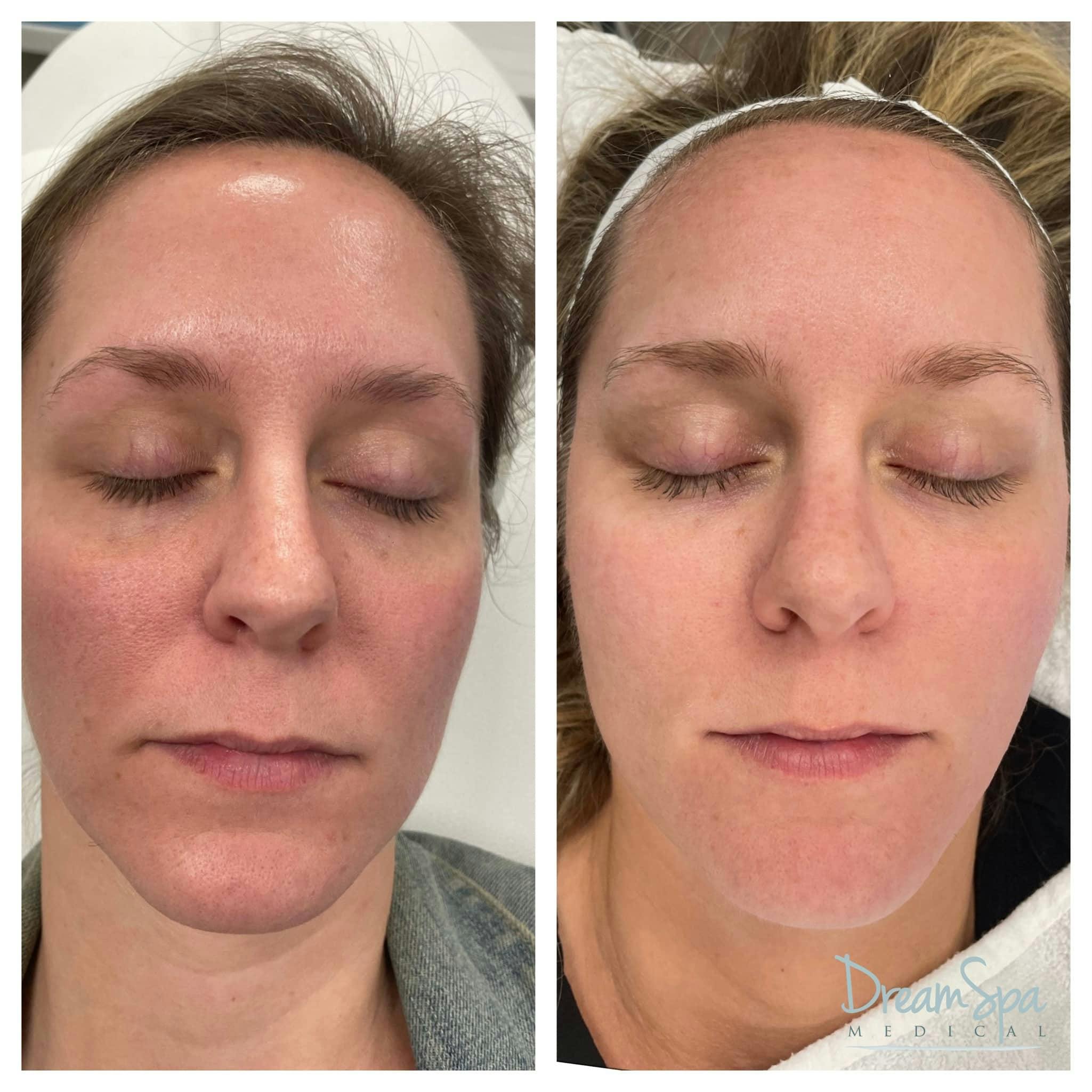 Skin Care Before & After Gallery - Patient 123429759 - Image 1