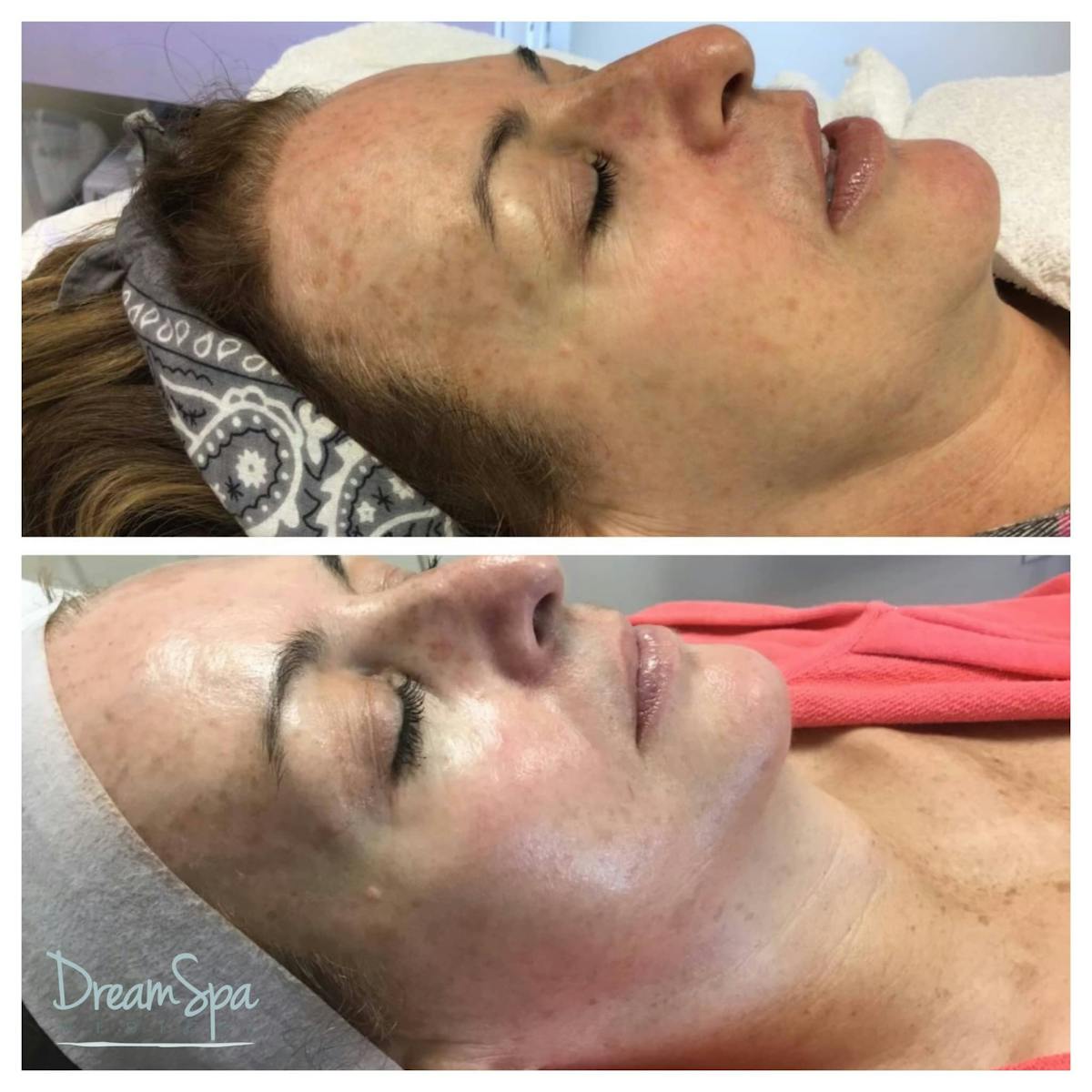 Skin Care Before & After Gallery - Patient 123429760 - Image 1