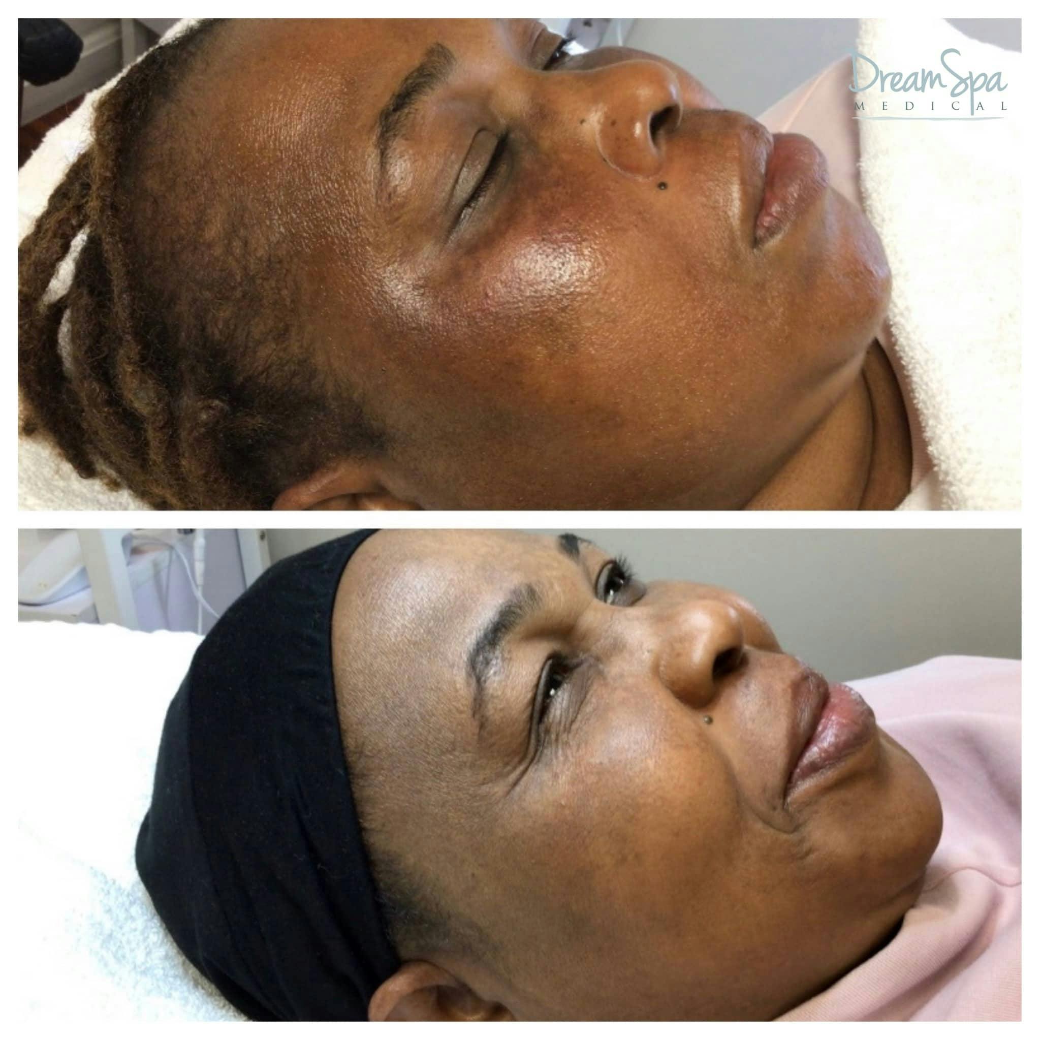 Skin Care Before & After Gallery - Patient 123429761 - Image 1