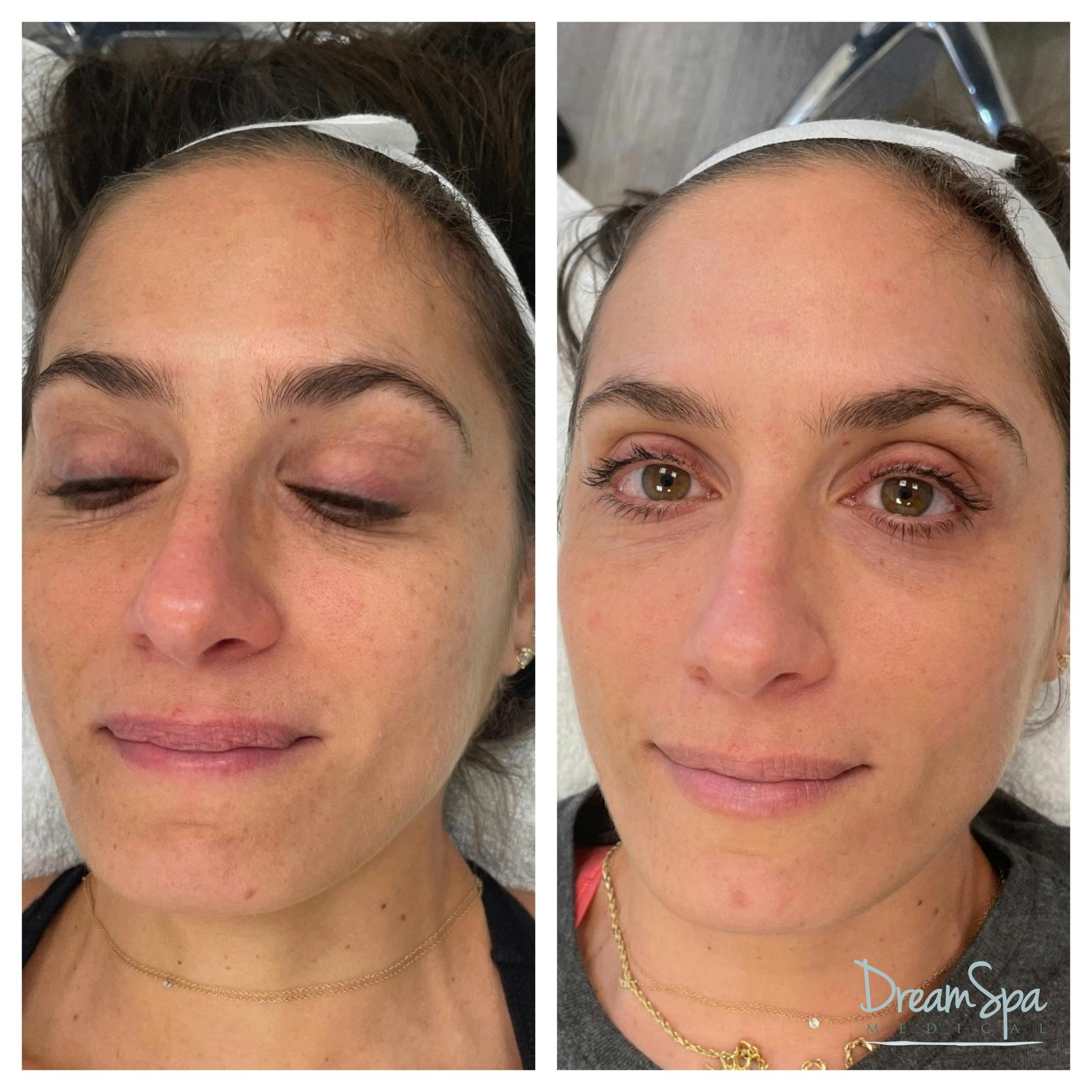 Skin Care Before & After Gallery - Patient 145103512 - Image 1