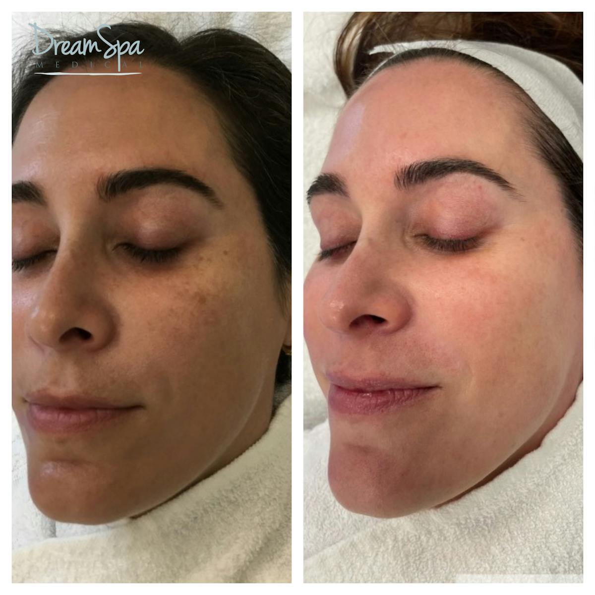 Skin Care Before & After Gallery - Patient 145103511 - Image 1