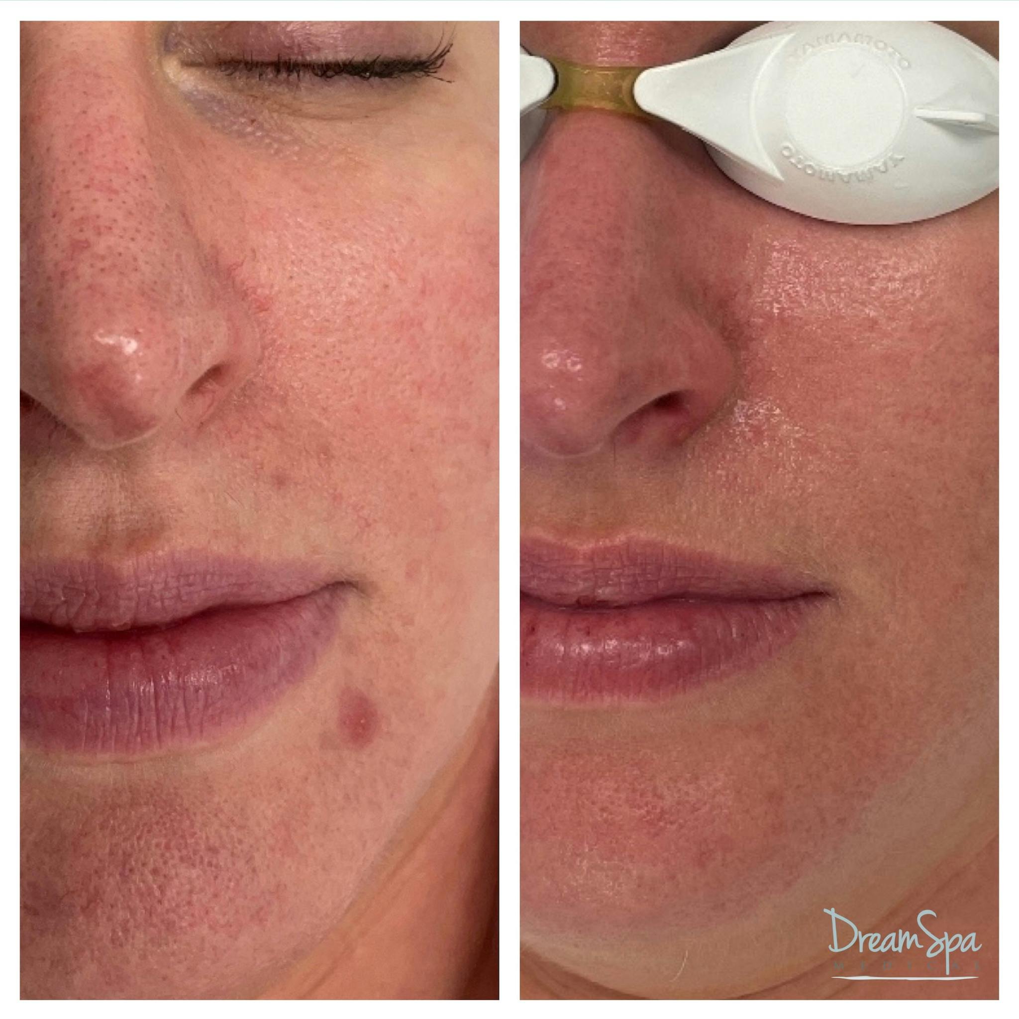 Skin Care Before & After Gallery - Patient 145103532 - Image 1