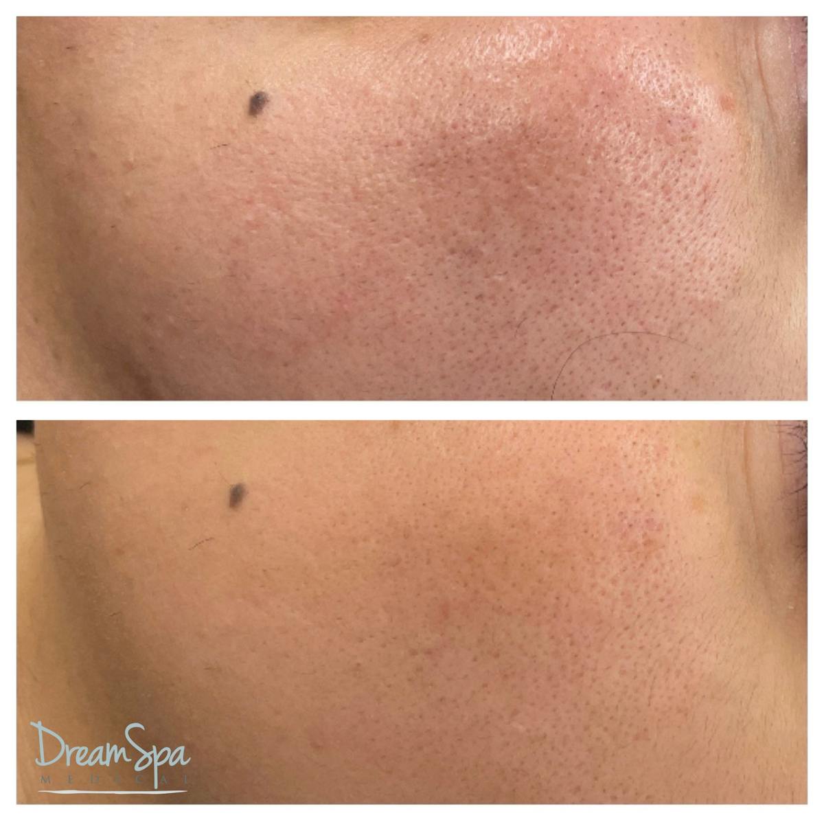 Skin Care Before & After Gallery - Patient 145103531 - Image 1