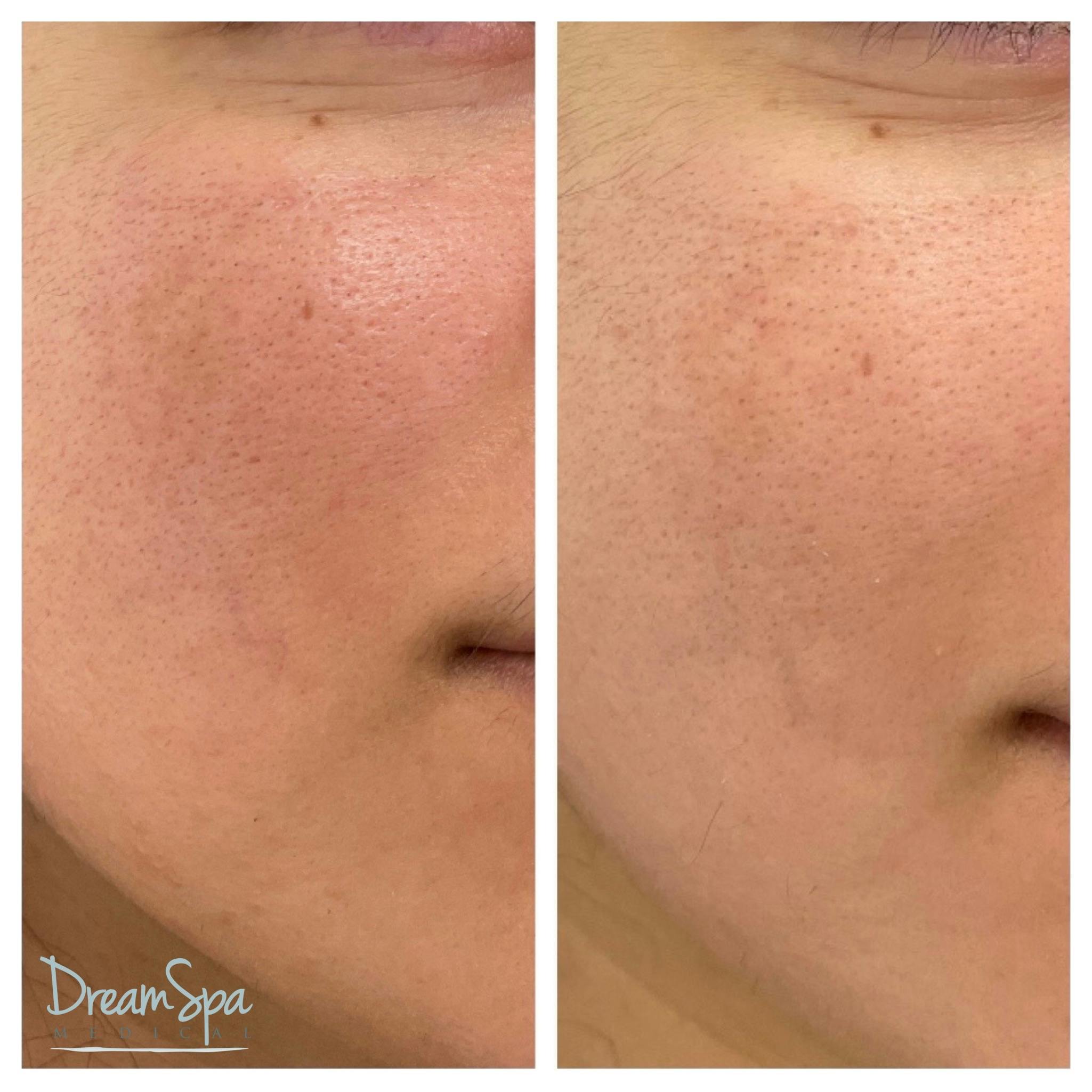 Skin Care Before & After Gallery - Patient 145103530 - Image 1
