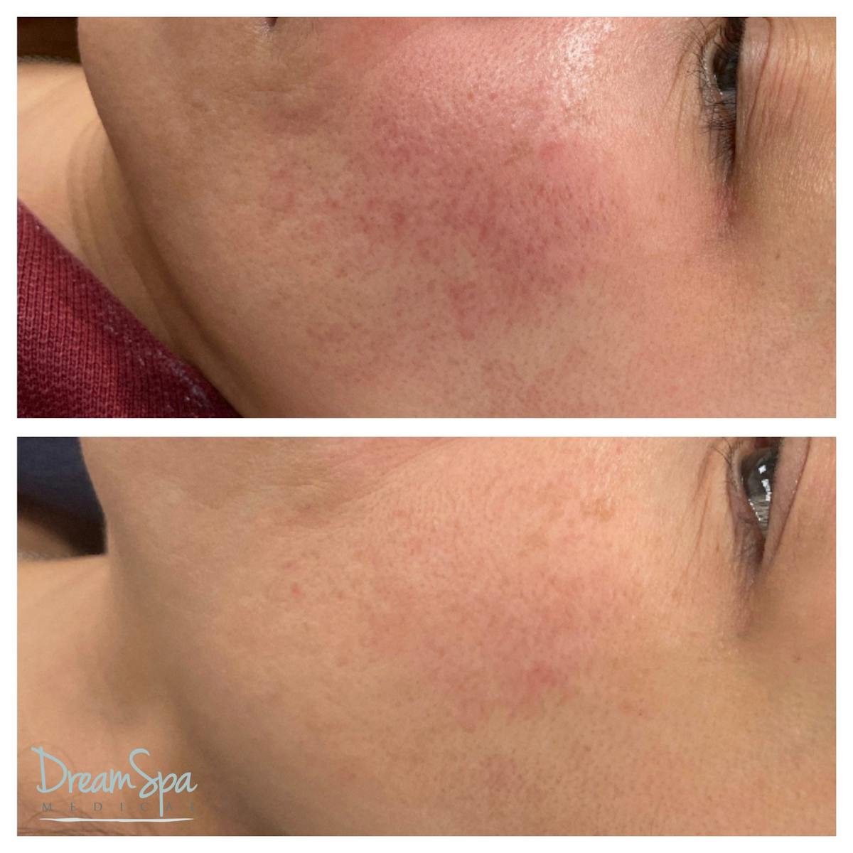 Skin Care Before & After Gallery - Patient 145103529 - Image 1
