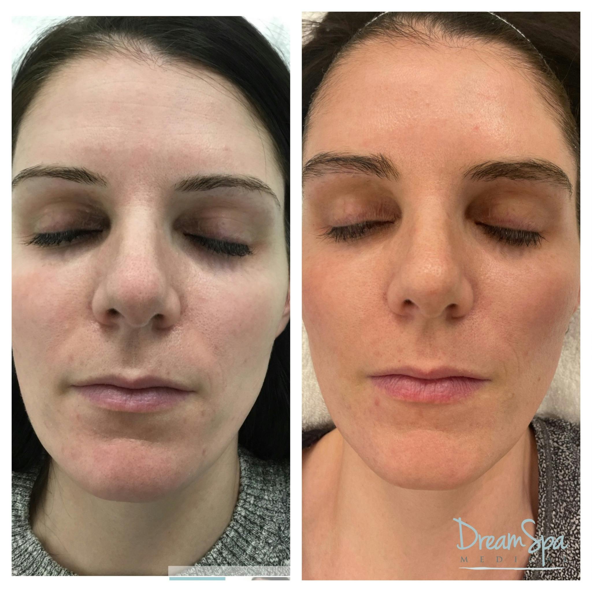 Skin Care Before & After Gallery - Patient 145103528 - Image 1