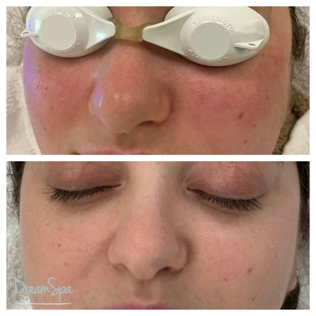 Skin Care Before & After Gallery - Patient 145103527 - Image 1