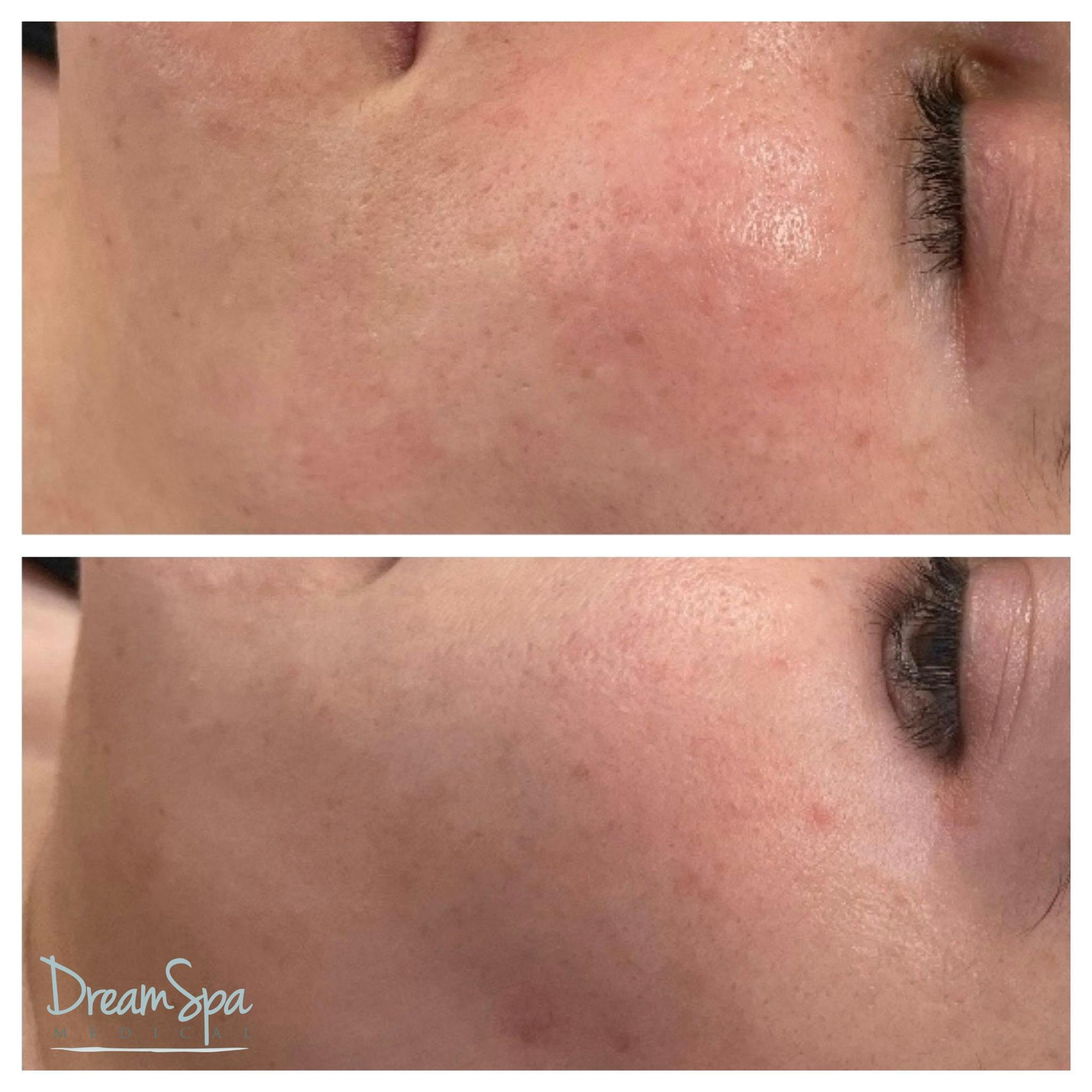 Skin Care Before & After Gallery - Patient 145103526 - Image 1