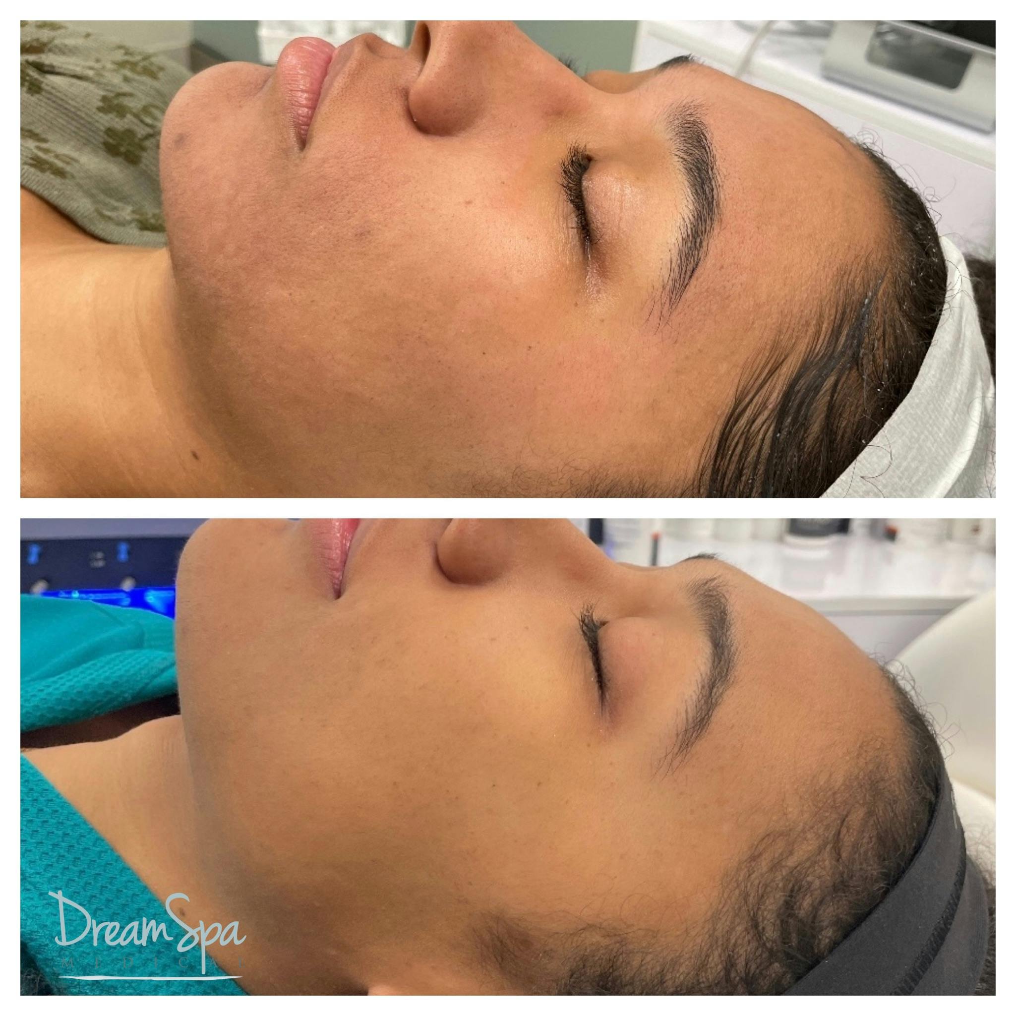Skin Care Before & After Gallery - Patient 145103525 - Image 1