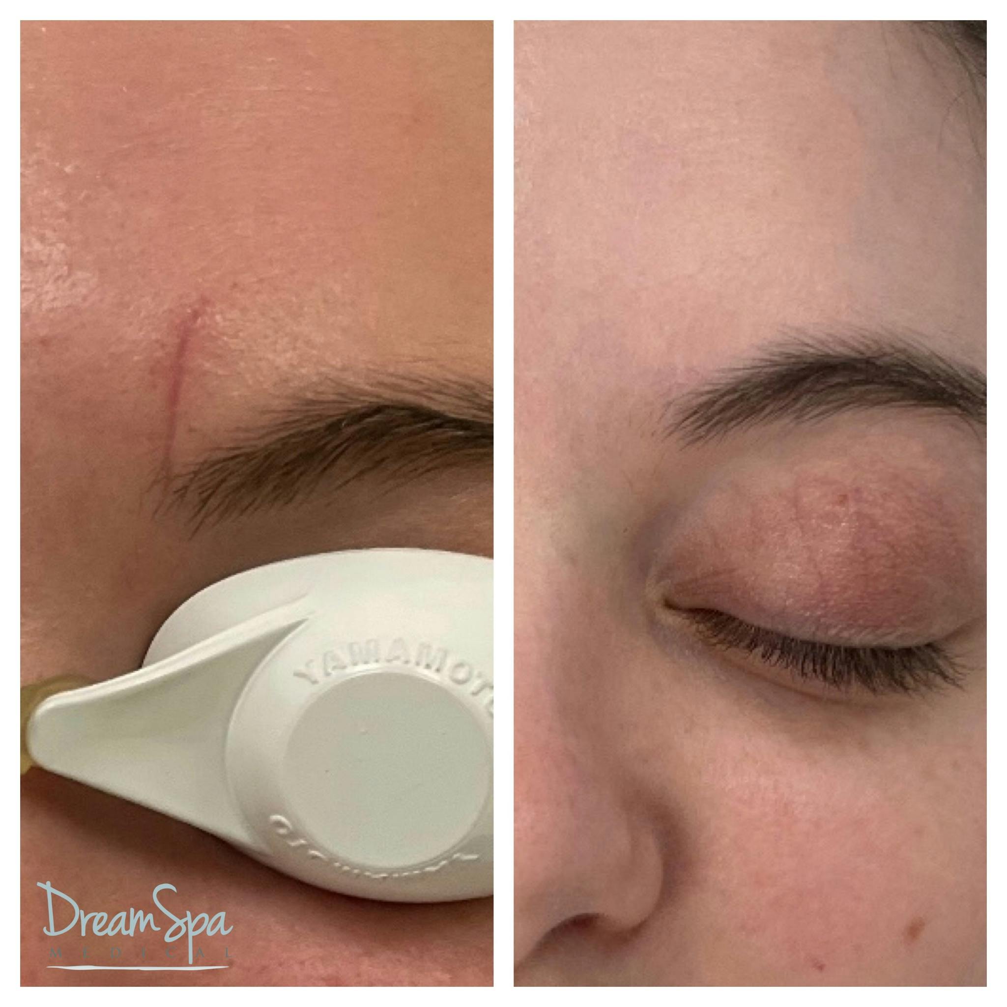 Skin Care Before & After Gallery - Patient 145103524 - Image 1