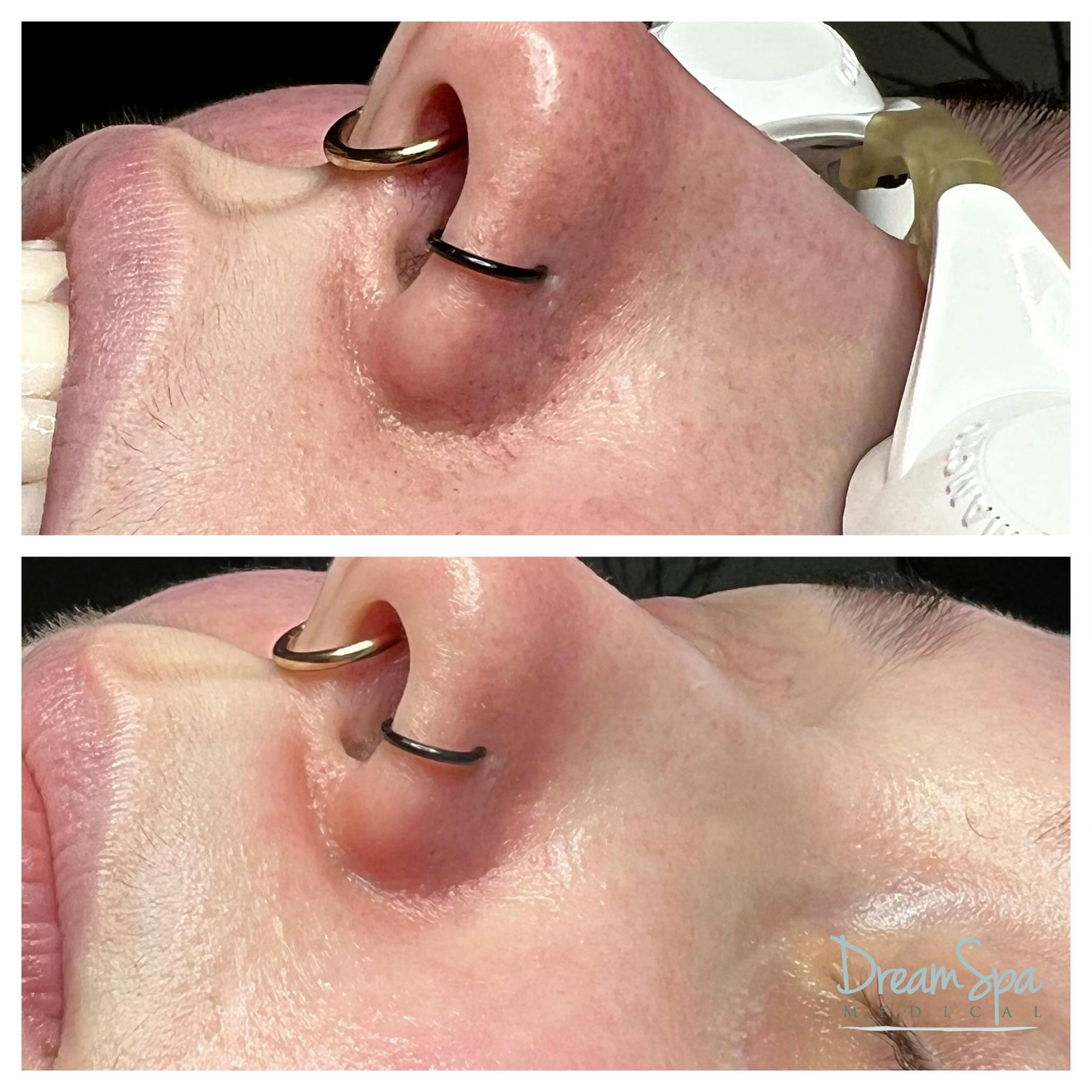 Skin Care Before & After Gallery - Patient 145103523 - Image 1