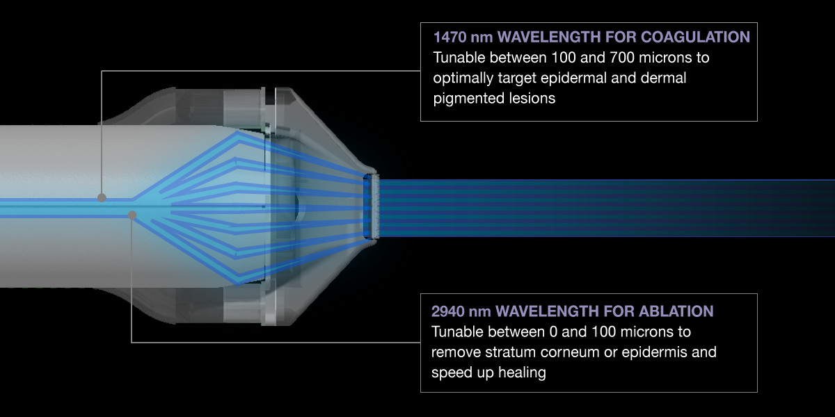 and animated image of the factional laser
