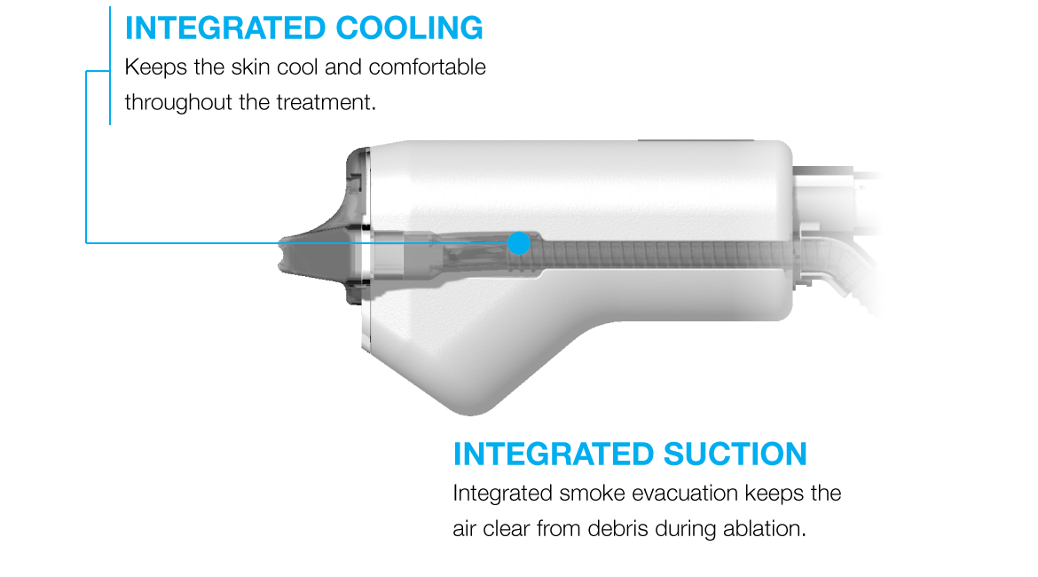 animation of the side provide of the halo laser