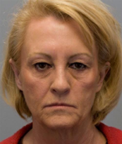 Eyelid Surgery (Upper Blepharoplasty) Before & After Gallery - Patient 58490571 - Image 3