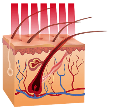 animation of hair follicles while using the laser hair cap