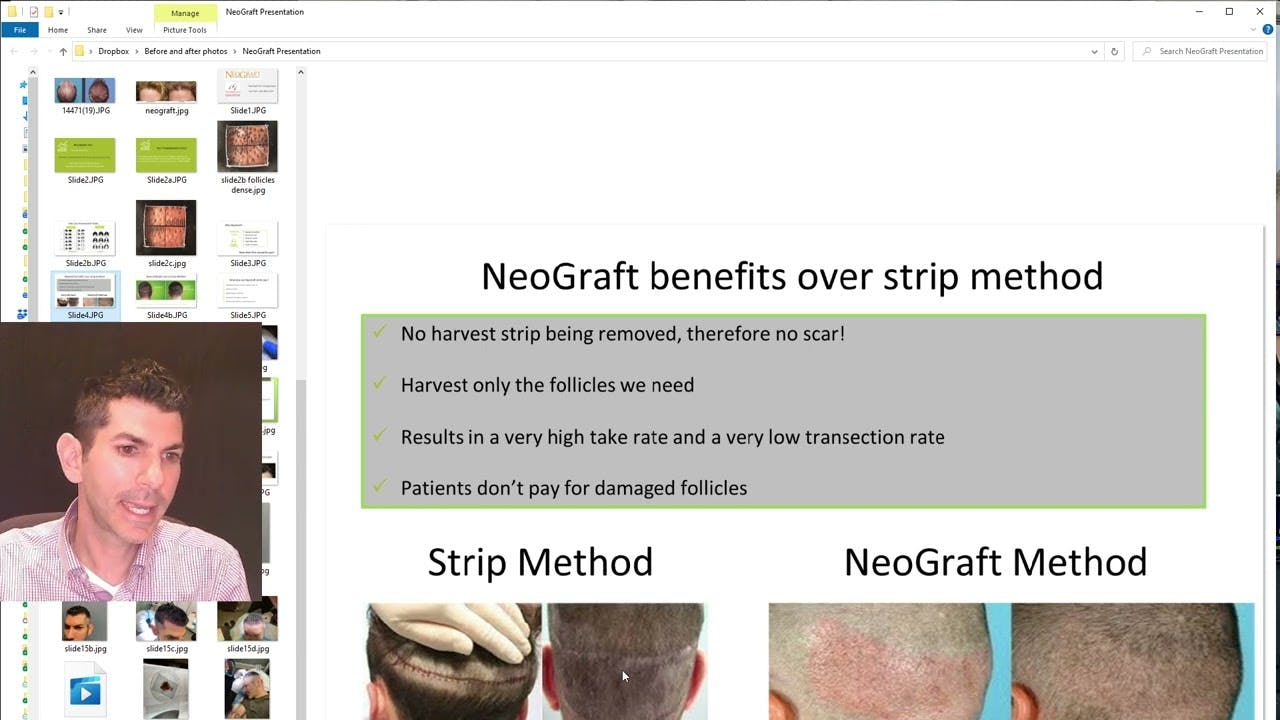 image of Dr. Cappuccino explaining NeoGraft Hair Transplantation and Hair Loss Treatment Options