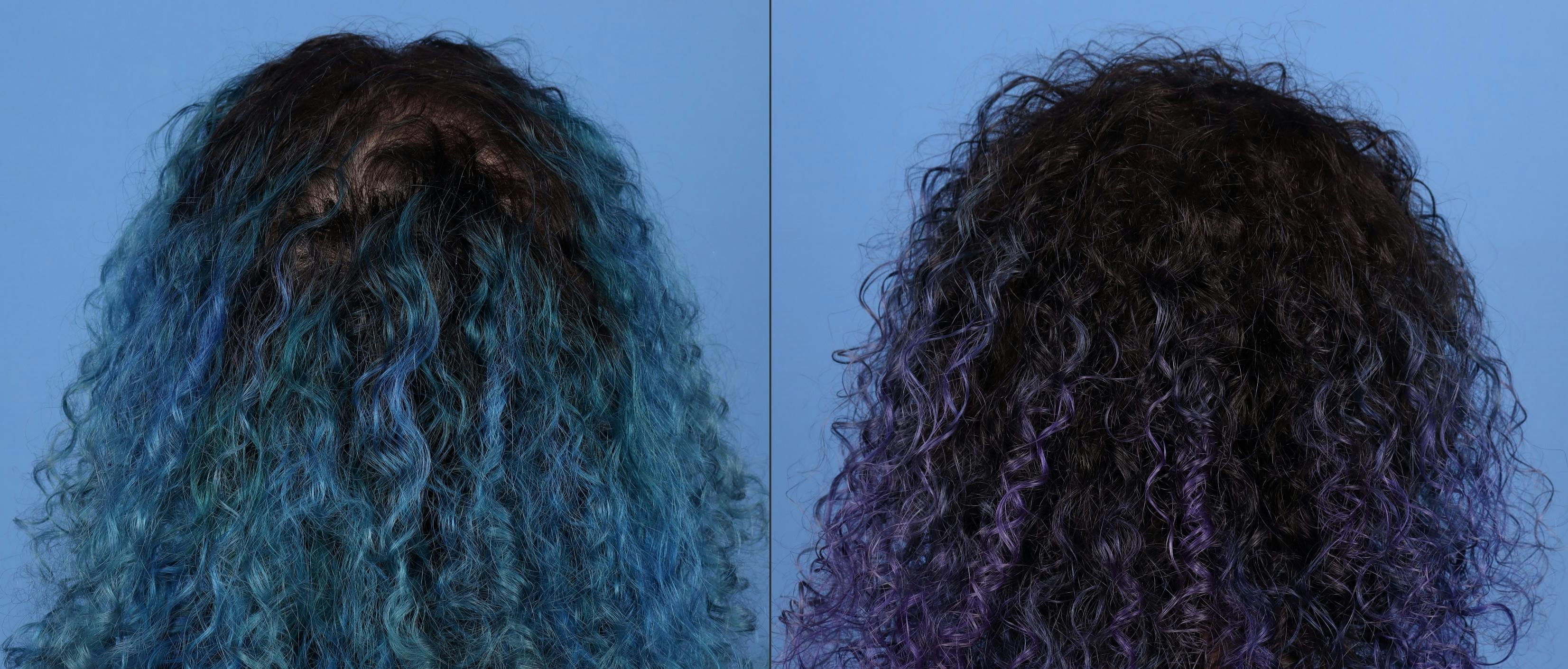 Female Hair Restoration Before & After Gallery - Patient 175247 - Image 2