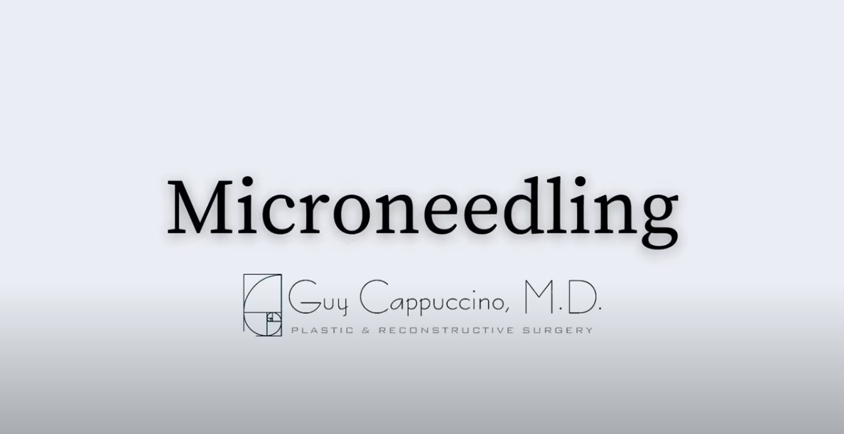 Microneedling with PRP