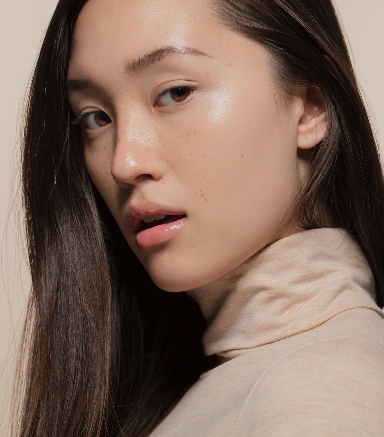 Lady who had Sculptra dermal filler