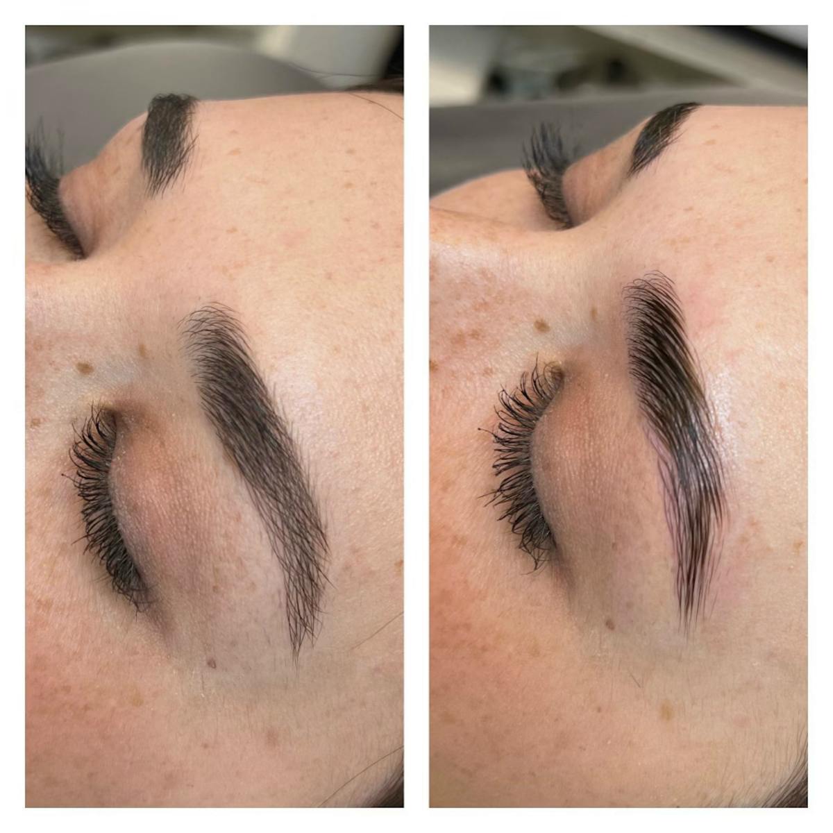 Brow Treatments Before & After Gallery - Patient 113533818 - Image 1