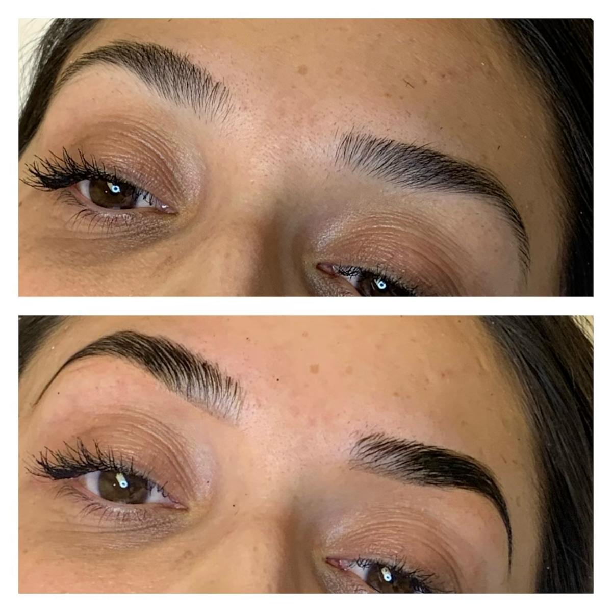 Brow Treatments Before & After Gallery - Patient 113533819 - Image 1