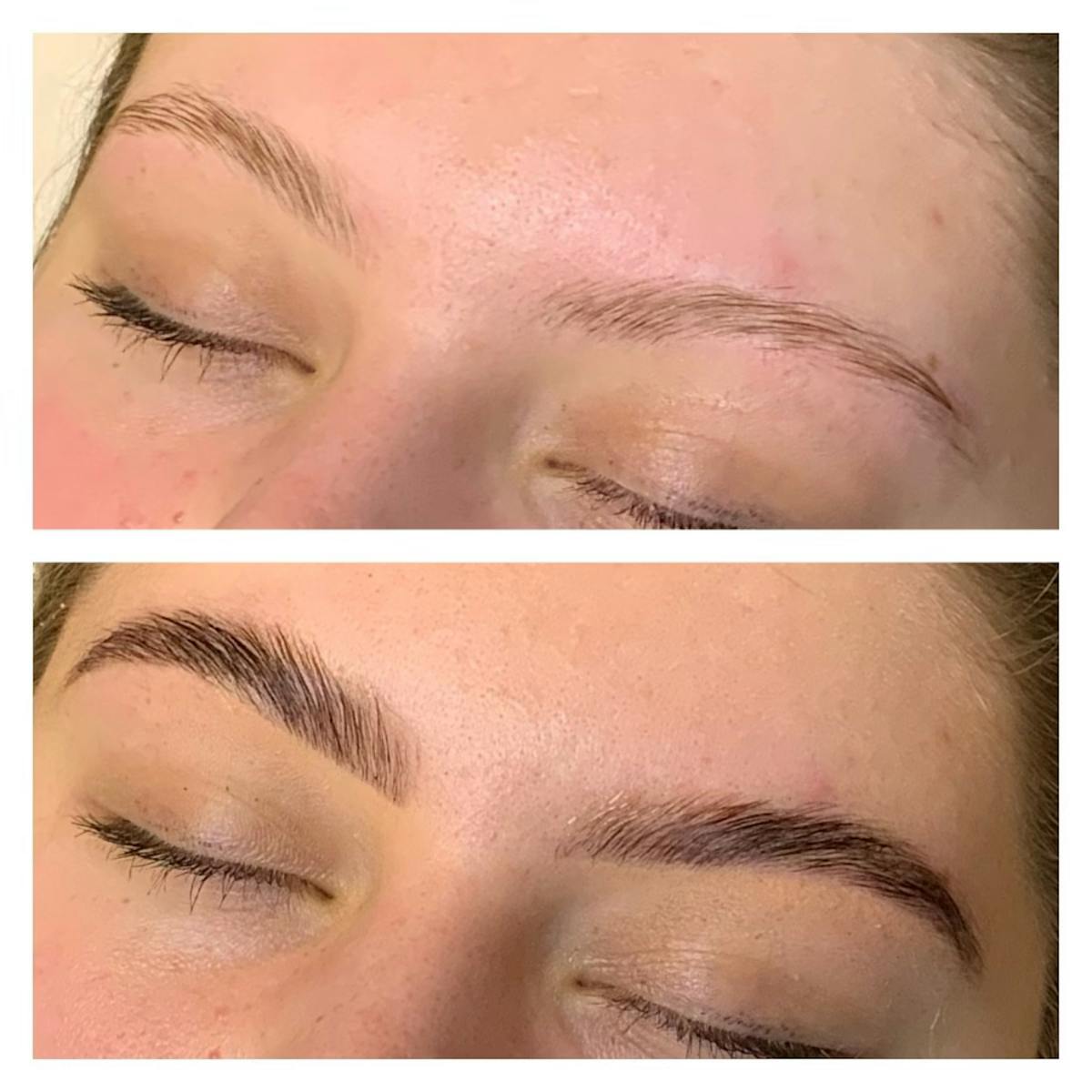 Brow Treatments Before & After Gallery - Patient 113533821 - Image 1