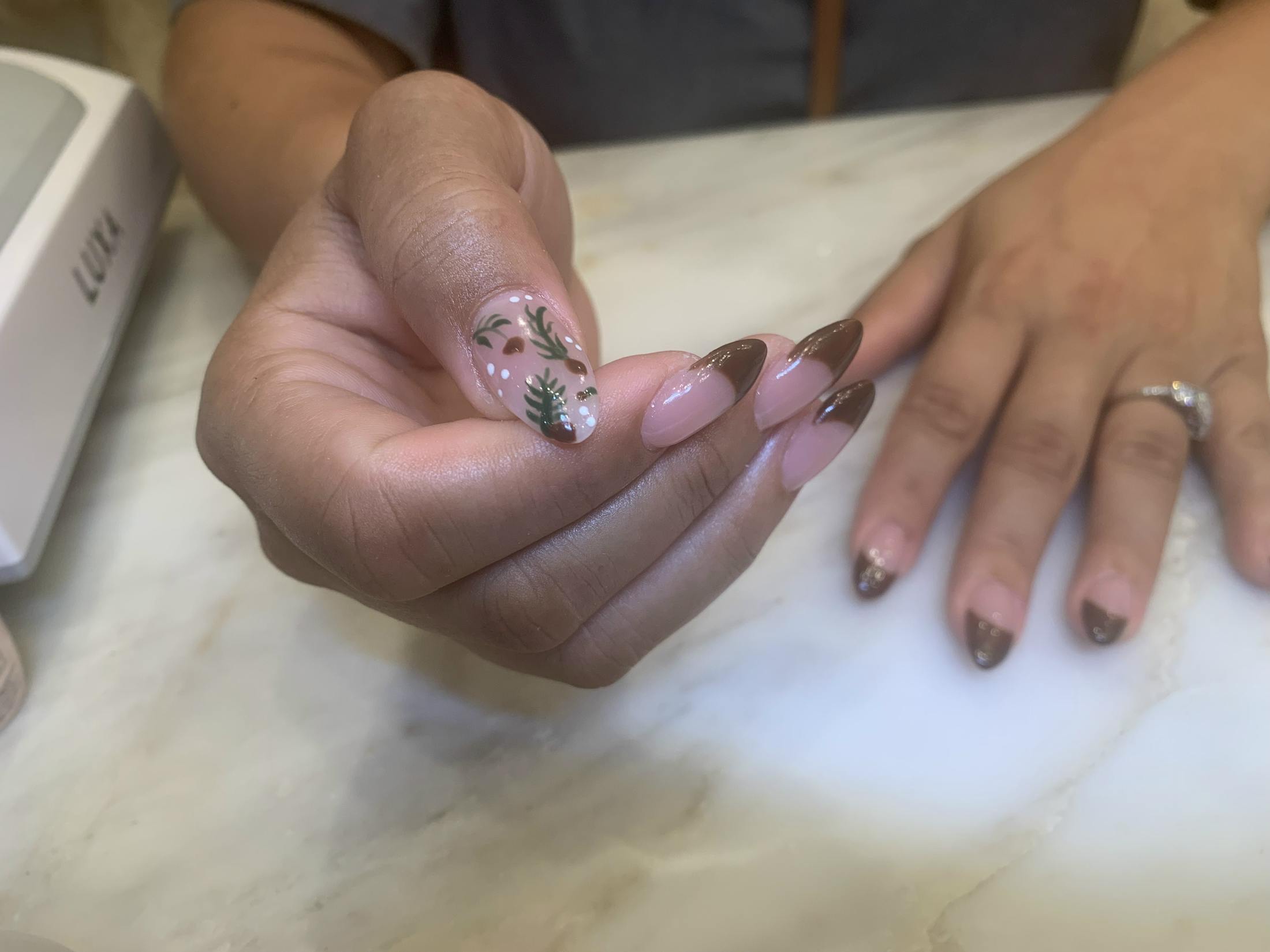 Signature Nail Treatments Before & After Gallery - Patient 113537061 - Image 1