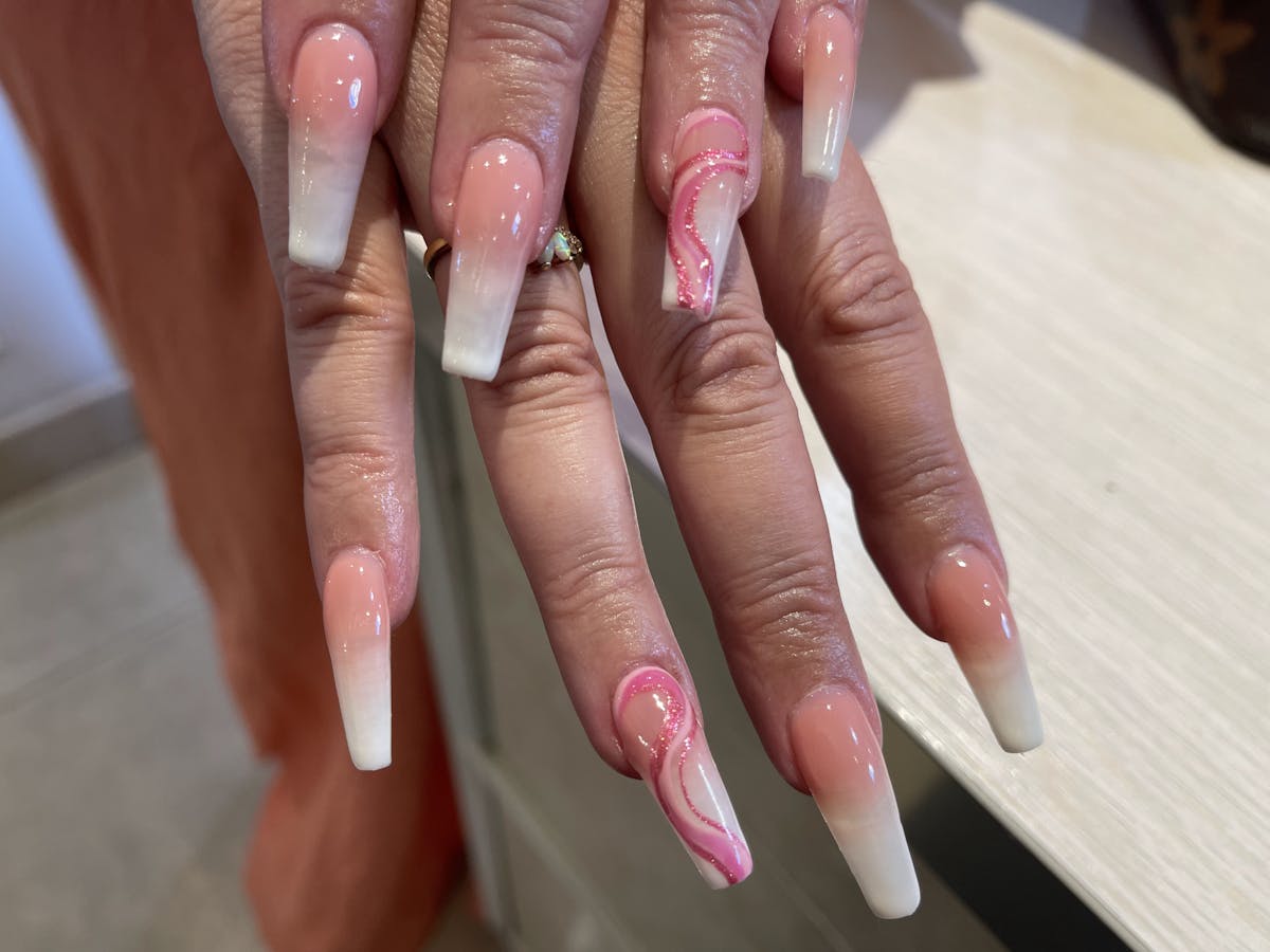 Signature Nail Treatments Before & After Gallery - Patient 113537062 - Image 1