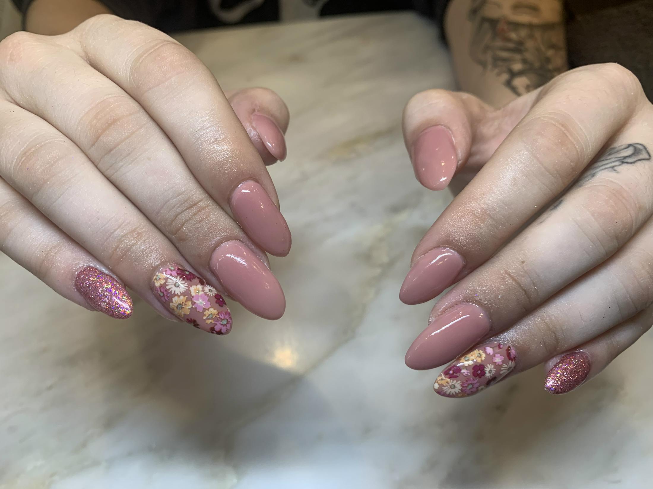 Signature Nail Treatments Before & After Gallery - Patient 113537063 - Image 1