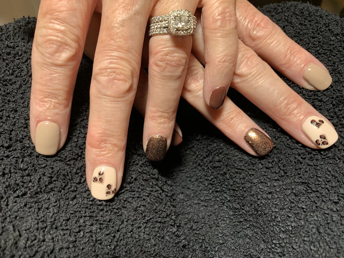 Signature Nail Treatments Before & After Gallery - Patient 113537065 - Image 1