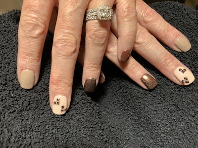 Signature Nail Treatments Before & After Gallery - Patient 113537065 - Image 1
