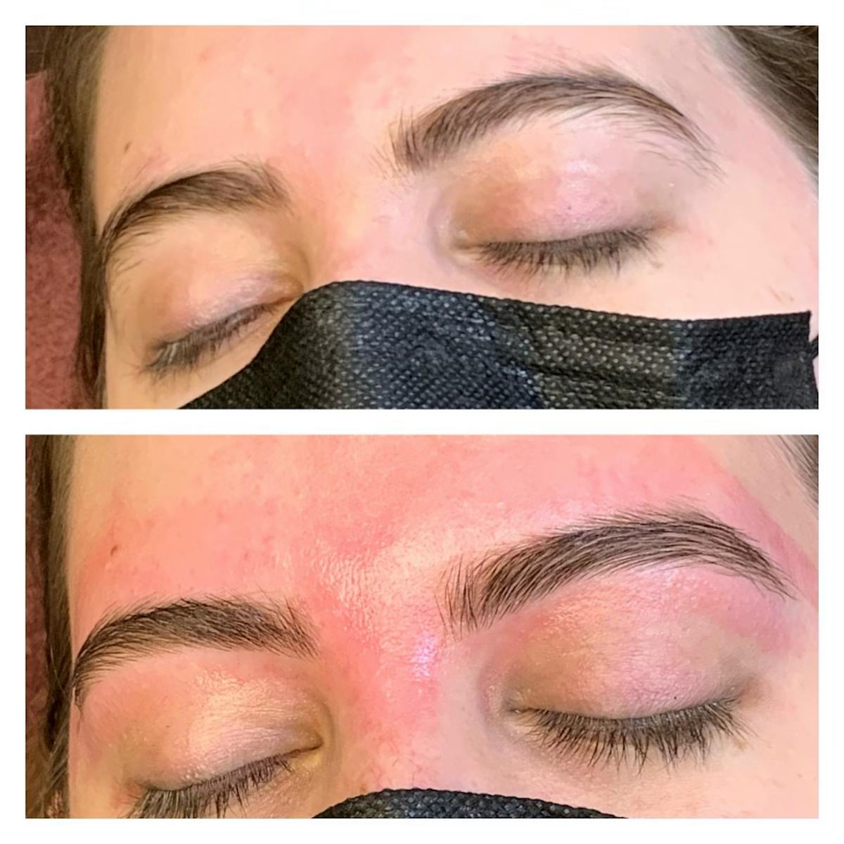 Brow Treatments Before & After Gallery - Patient 118556292 - Image 1