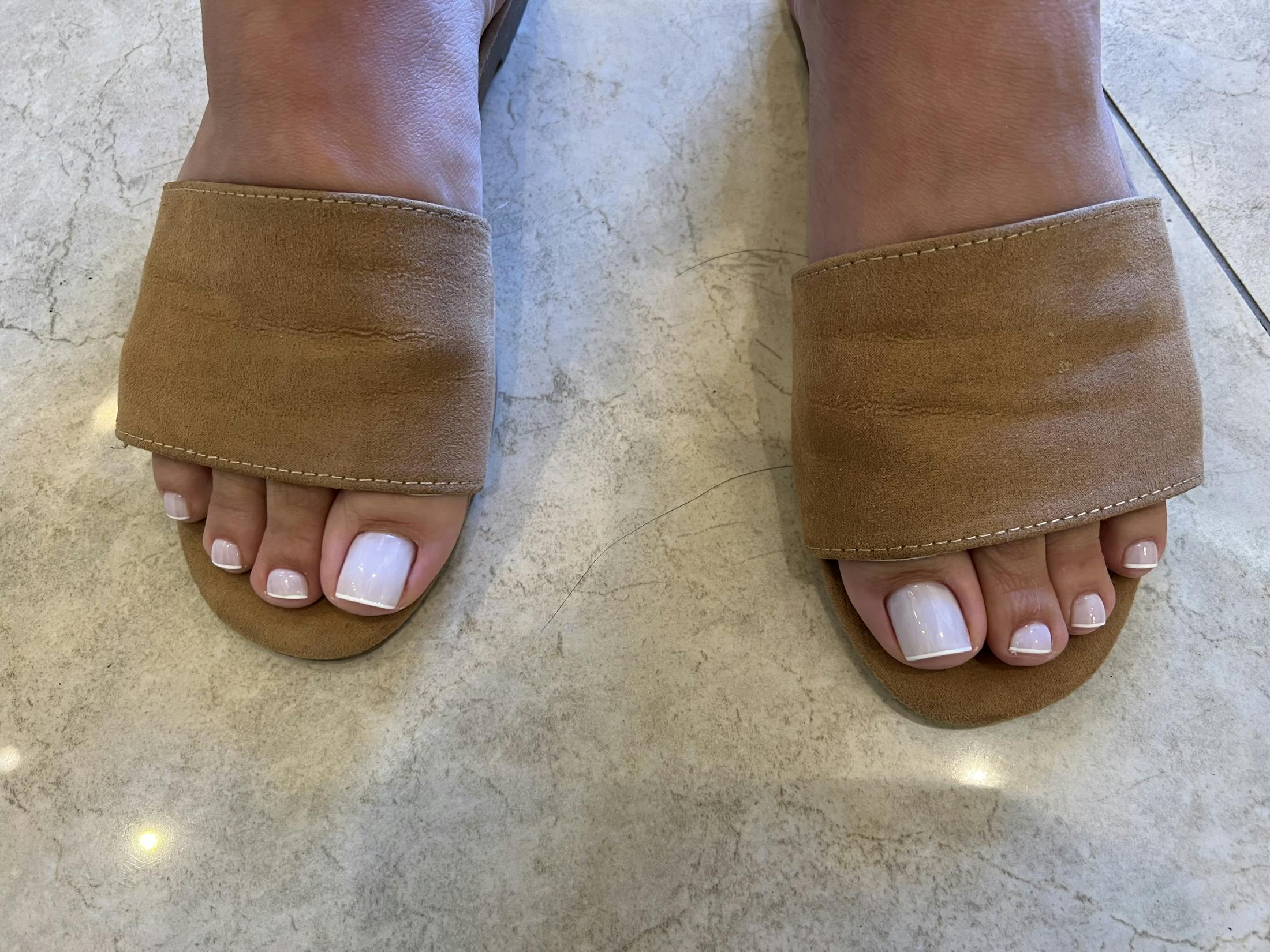 Signature Nail Treatments Before & After Gallery - Patient 122582856 - Image 1