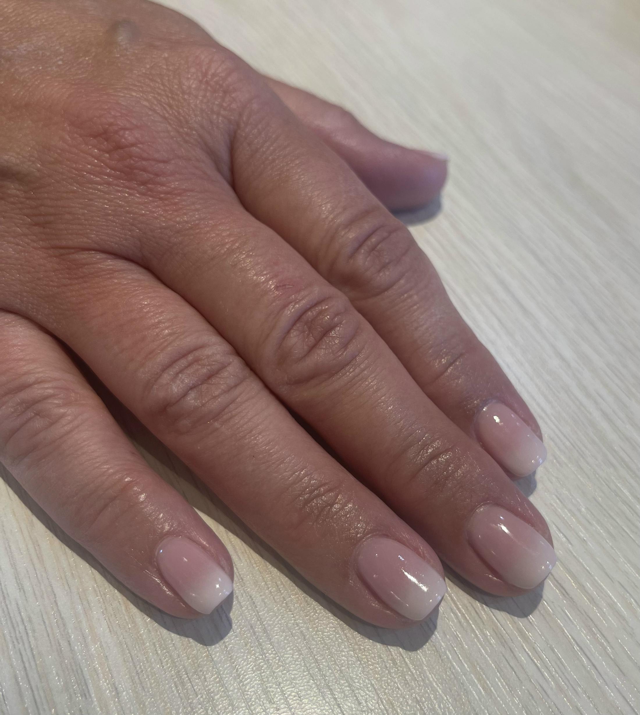 Signature Nail Treatments Before & After Gallery - Patient 122727369 - Image 1