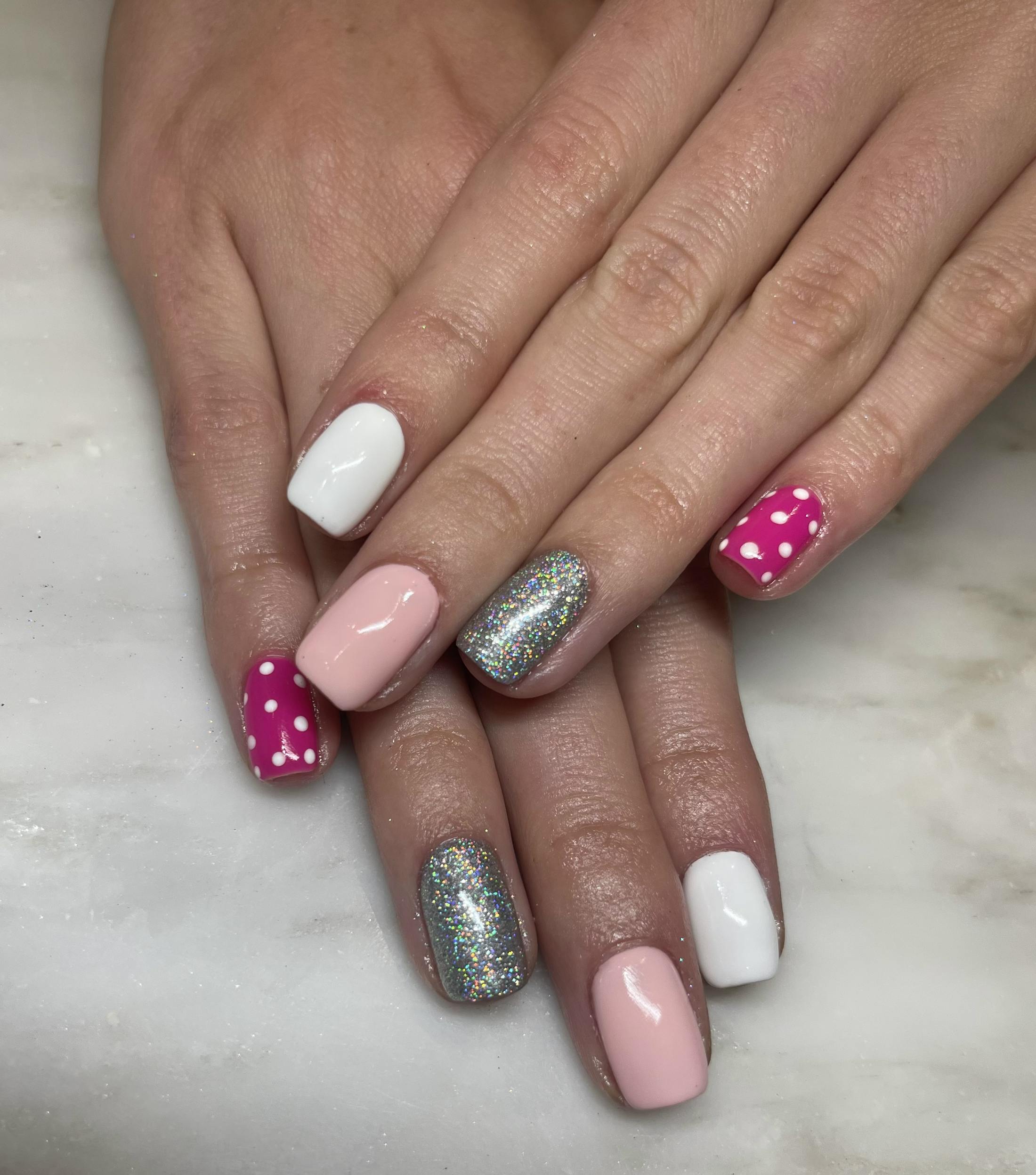 Signature Nail Treatments Before & After Gallery - Patient 122727368 - Image 1