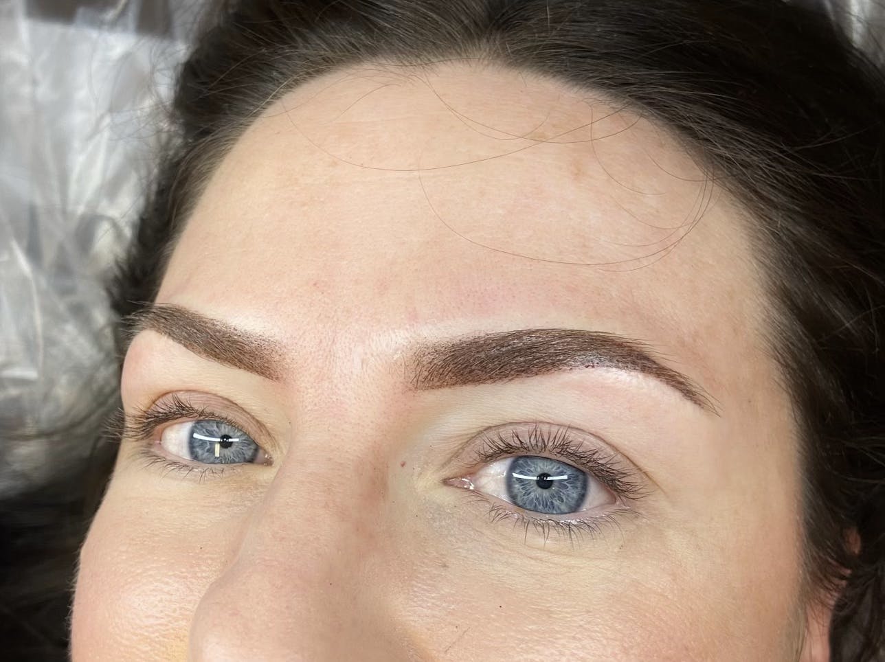 Brow Treatments Before & After Gallery - Patient 141201305 - Image 1