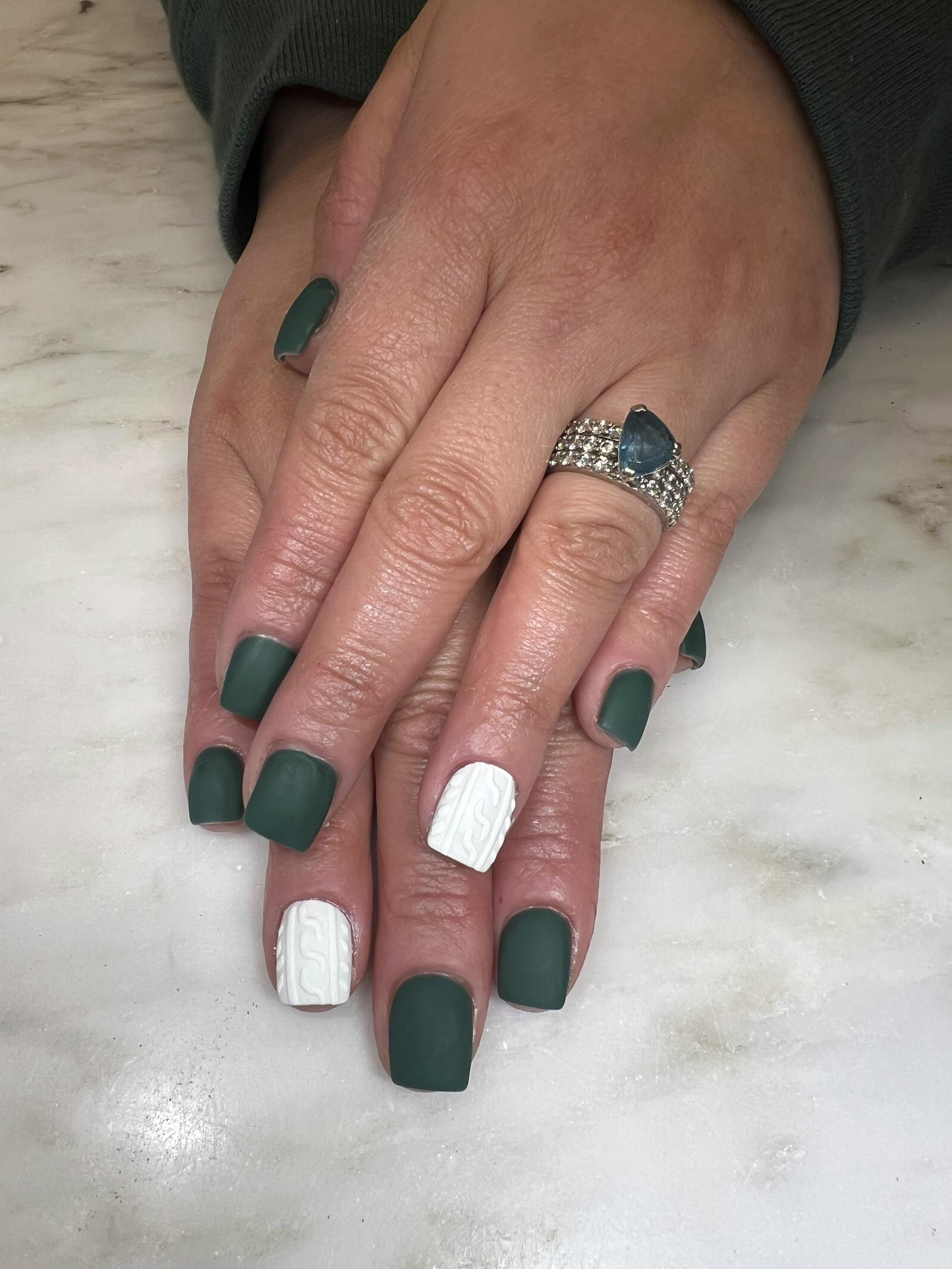 Signature Nail Treatments Before & After Gallery - Patient 145033985 - Image 1