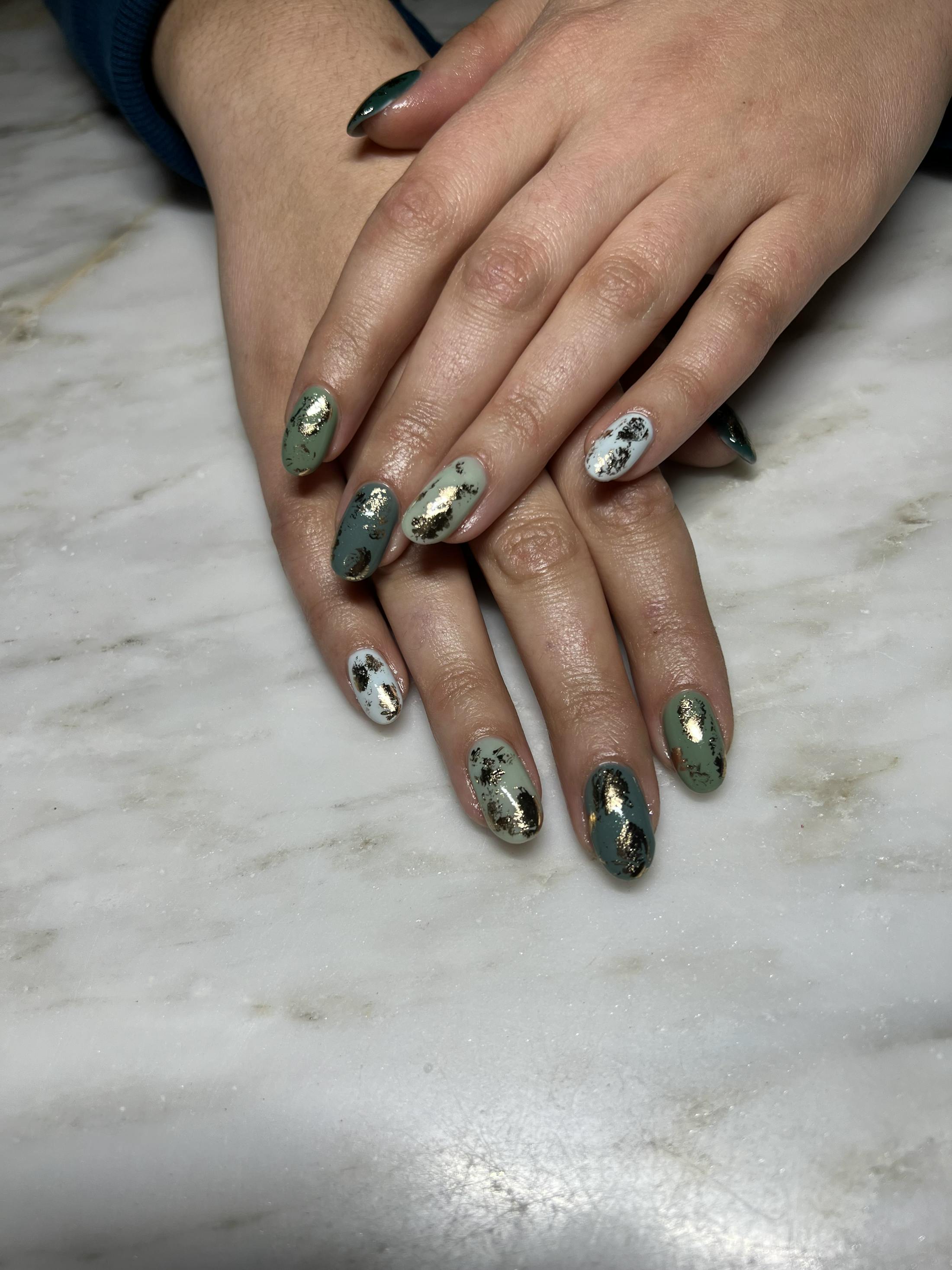 Signature Nail Treatments Before & After Gallery - Patient 145033986 - Image 1
